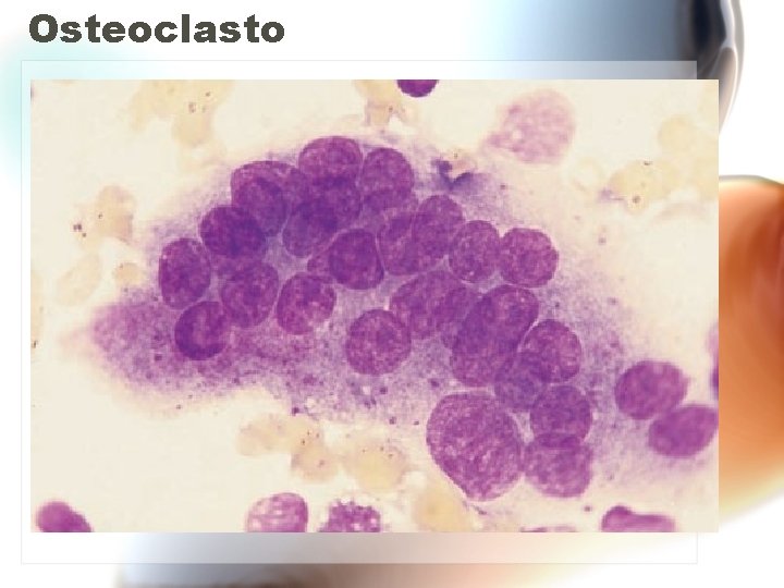 Osteoclasto Osteoclasto