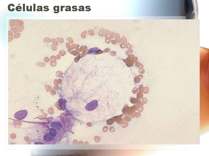 Células grasas Células grasas