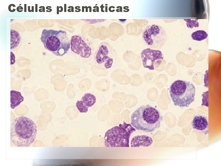 Células plasmáticas Células plasmáticas
