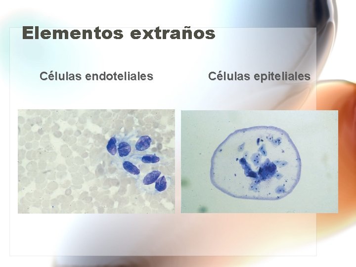 Elementos extraños Células endoteliales Células epiteliales Elementos extraños Células endoteliales Células epiteliales