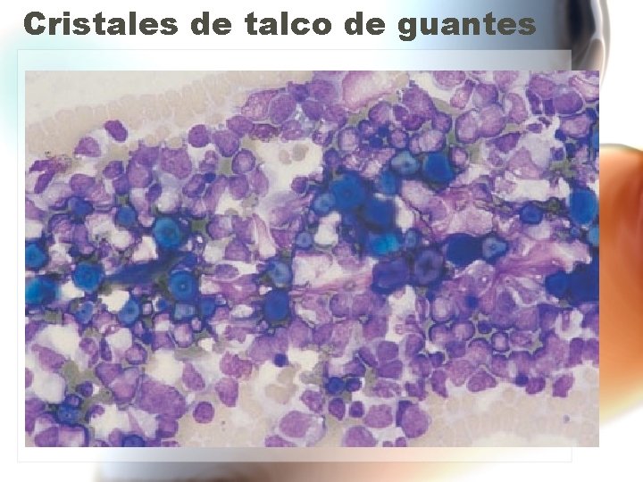 Cristales de talco de guantes Cristales de talco de guantes