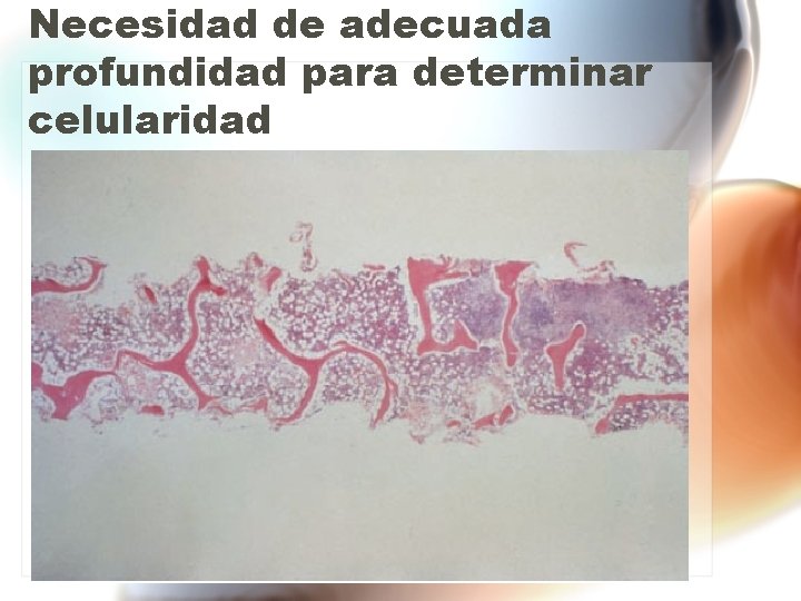 Necesidad de adecuada profundidad para determinar celularidad Necesidad de adecuada profundidad para determinar celularidad