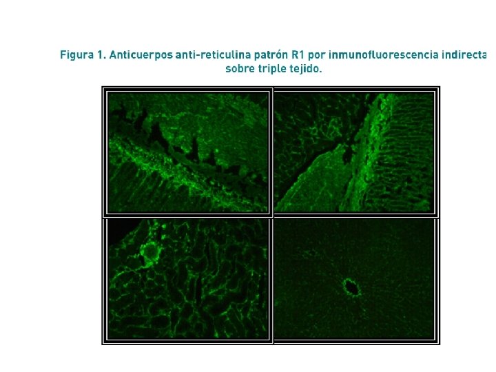 Informe del laboratorio 