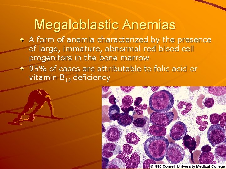 Megaloblastic Anemias A form of anemia characterized by the presence of large, immature, abnormal