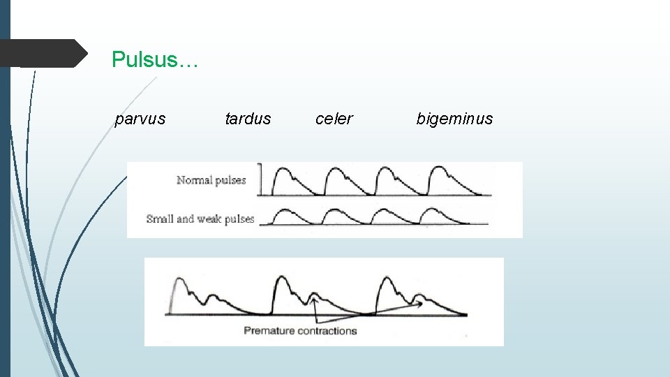 Pulsus… parvus tardus celer bigeminus 