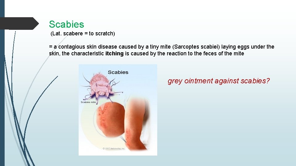 Scabies (Lat. scabere = to scratch) = a contagious skin disease caused by a