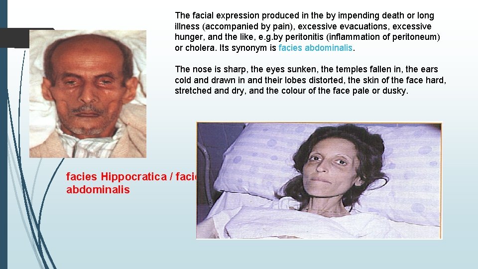 The facial expression produced in the by impending death or long illness (accompanied by