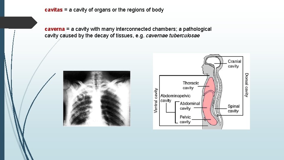 cavitas = a cavity of organs or the regions of body caverna = a