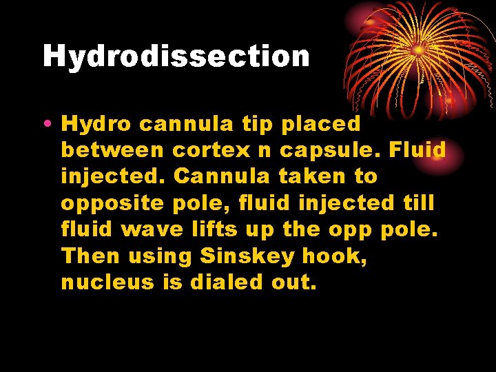 Hydrodissection • Hydro cannula tip placed between cortex n capsule. Fluid injected. Cannula taken
