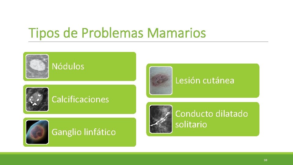 Tipos de Problemas Mamarios Nódulos Lesión cutánea Calcificaciones Ganglio linfático Conducto dilatado solitario 10 Tipos de Problemas Mamarios Nódulos Lesión cutánea Calcificaciones Ganglio linfático Conducto dilatado solitario 10