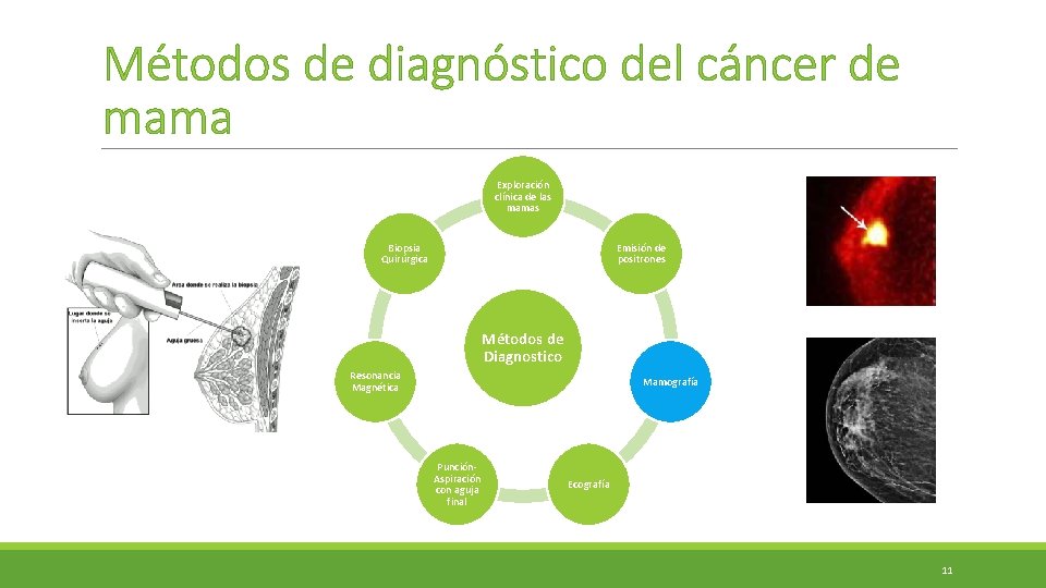 Métodos de diagnóstico del cáncer de mama Exploración clínica de las mamas Biopsia Quirúrgica Métodos de diagnóstico del cáncer de mama Exploración clínica de las mamas Biopsia Quirúrgica