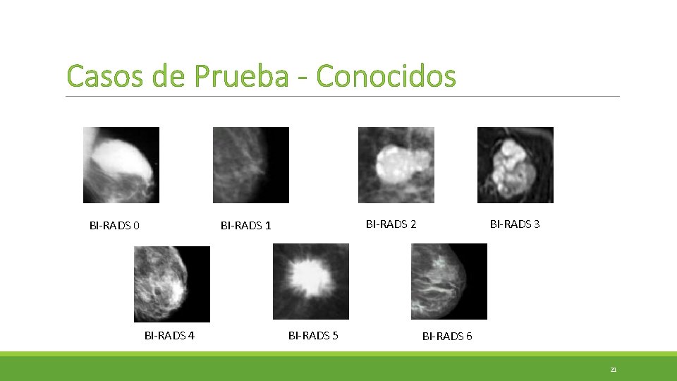 Casos de Prueba - Conocidos BI-RADS 0 BI-RADS 2 BI-RADS 1 BI-RADS 4 BI-RADS Casos de Prueba - Conocidos BI-RADS 0 BI-RADS 2 BI-RADS 1 BI-RADS 4 BI-RADS