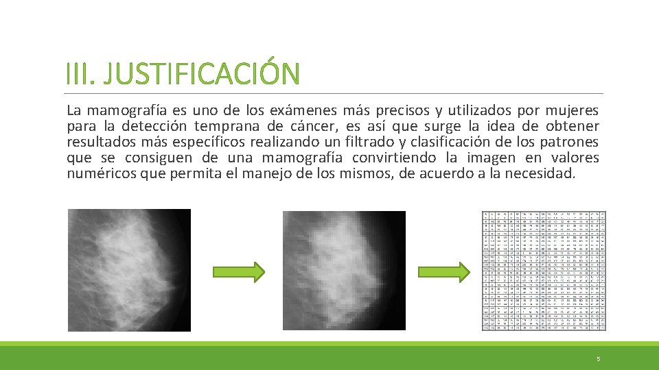 III. JUSTIFICACIÓN La mamografía es uno de los exámenes más precisos y utilizados por III. JUSTIFICACIÓN La mamografía es uno de los exámenes más precisos y utilizados por