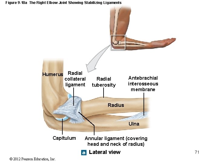 Figure 9 -10 a The Right Elbow Joint Showing Stabilizing Ligaments Humerus Radial collateral