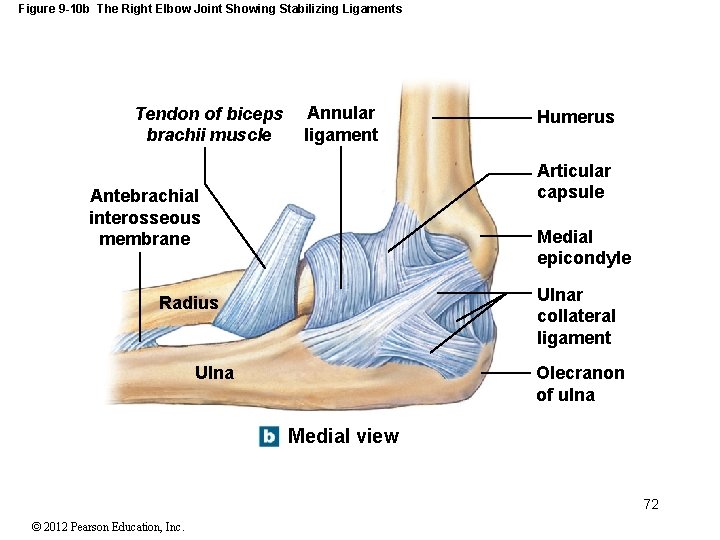 Figure 9 -10 b The Right Elbow Joint Showing Stabilizing Ligaments Tendon of biceps