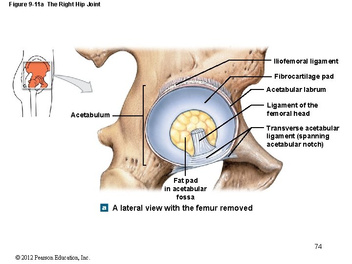 Figure 9 -11 a The Right Hip Joint Iliofemoral ligament Fibrocartilage pad Acetabular labrum