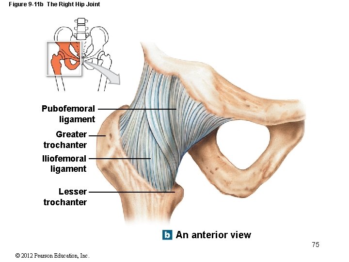 Figure 9 -11 b The Right Hip Joint Pubofemoral ligament Greater trochanter Iliofemoral ligament