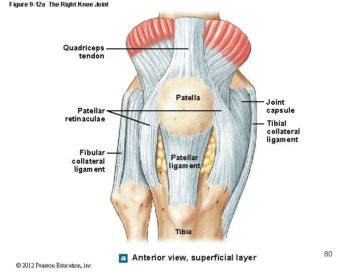 Figure 9 -12 a The Right Knee Joint Quadriceps tendon Patellar retinaculae Fibular collateral