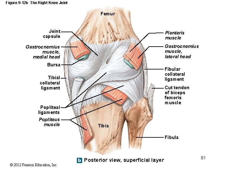 Figure 9 -12 b The Right Knee Joint Femur Joint capsule Plantaris muscle Gastrocnemius