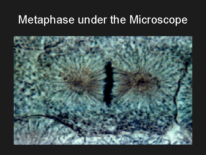 Metaphase under the Microscope 