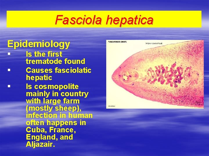 Fasciola hepatica Epidemiology § § § Is the first trematode found Causes fasciolatic hepatic