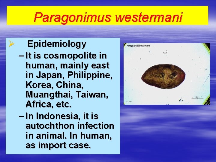 Paragonimus westermani Ø Epidemiology – It is cosmopolite in human, mainly east in Japan,