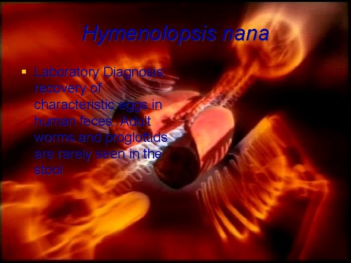 Hymenolopsis nana § Laboratory Diagnosis: recovery of characteristic eggs in human feces. Adult worms