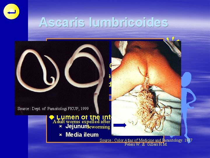 Ascaris lumbricoides DISTRIBUTION u Cosmopolitan u Prevalence 70 -90 % u Primarily affects underfives
