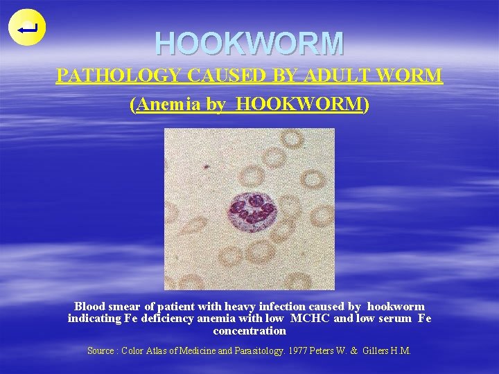 HOOKWORM PATHOLOGY CAUSED BY ADULT WORM (Anemia by HOOKWORM) Blood smear of patient with