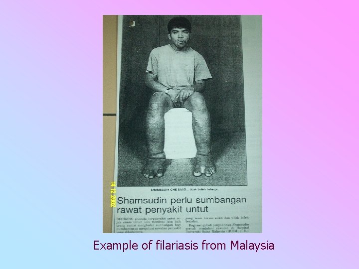 Example of filariasis from Malaysia 