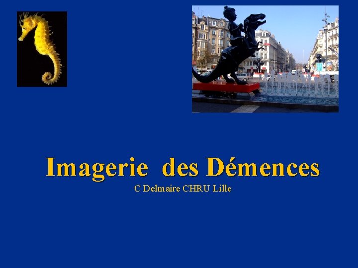 Imagerie des Démences C Delmaire CHRU Lille 