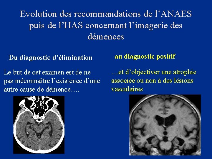 Evolution des recommandations de l’ANAES puis de l’HAS concernant l’imagerie des démences Du diagnostic
