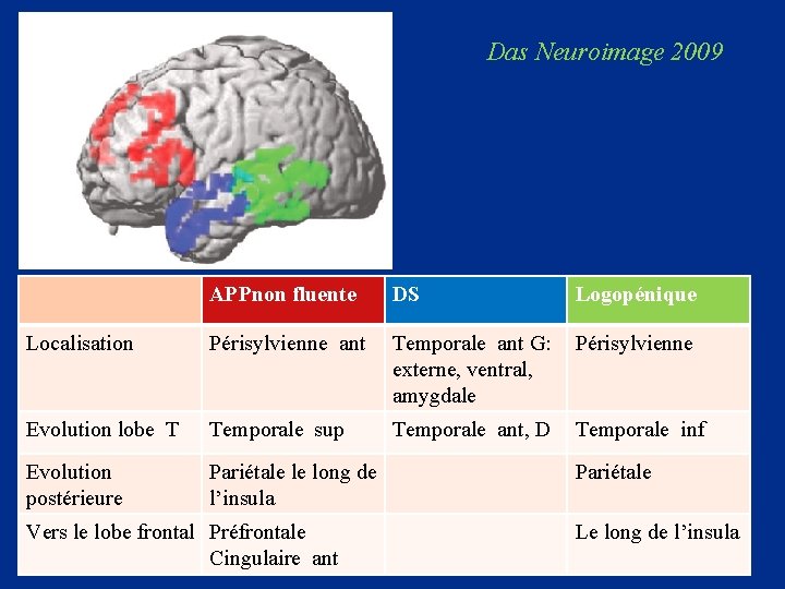 Das Neuroimage 2009 APPnon fluente DS Localisation Périsylvienne ant Temporale ant G: Périsylvienne externe,