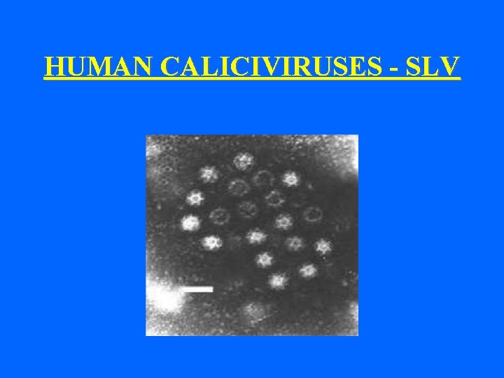 HUMAN CALICIVIRUSES - SLV 