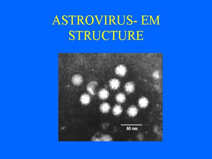 ASTROVIRUS- EM STRUCTURE 