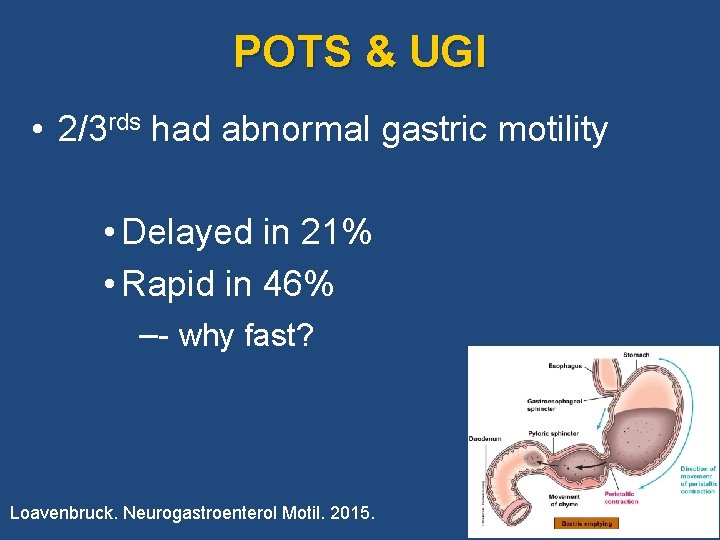 POTS & UGI • 2/3 rds had abnormal gastric motility • Delayed in 21%