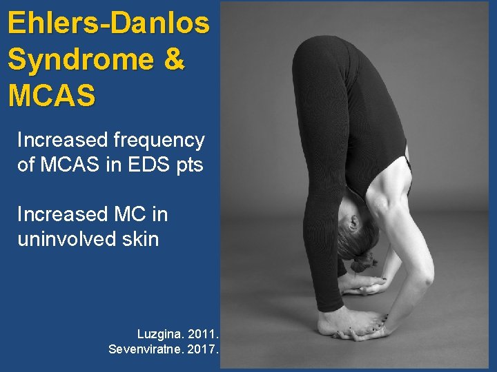 Ehlers-Danlos Syndrome & MCAS Increased frequency of MCAS in EDS pts Increased MC in