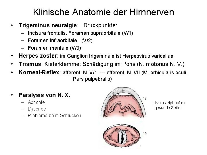 Klinische Anatomie der Hirnnerven • Trigeminus neuralgie: Druckpunkte: – Incisura frontalis, Foramen supraorbitale (V/1)