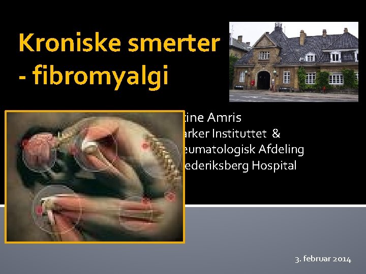 Kroniske smerter - fibromyalgi Stine Amris Parker Instituttet & Reumatologisk Afdeling Frederiksberg Hospital 3.