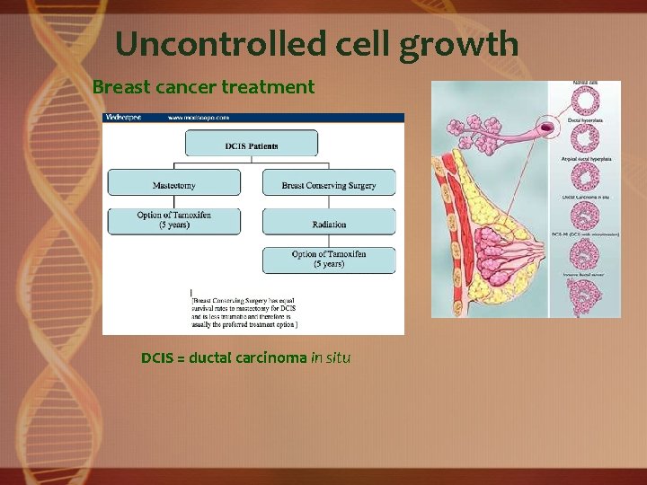 Uncontrolled cell growth Breast cancer treatment DCIS = ductal carcinoma in situ 