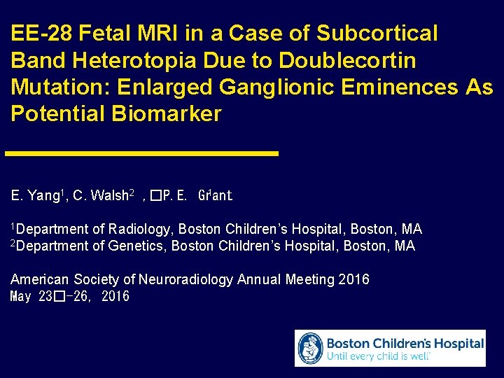 EE-28 Fetal MRI in a Case of Subcortical Band Heterotopia Due to Doublecortin Mutation: