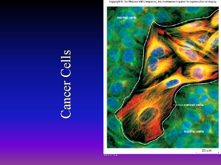 2011 -12 Cancer Cells 