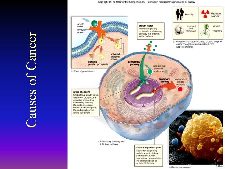 2011 -12 Causes of Cancer 