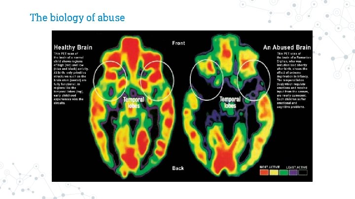 The biology of abuse 