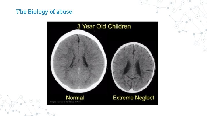 The Biology of abuse 