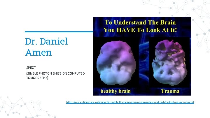 Dr. Daniel Amen SPECT (SINGLE PHOTON EMISSION COMPUTED TOMOGRAPHY) https: //www. slideshare. net/robertinseattle/dr-daniel-amen-independent-retired-football-players-summit 