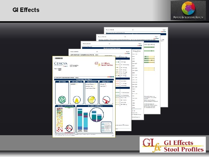 GI Effects 