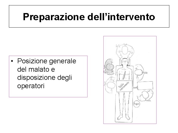 Preparazione dell’intervento • Posizione generale del malato e disposizione degli operatori Preparazione dell’intervento • Posizione generale del malato e disposizione degli operatori