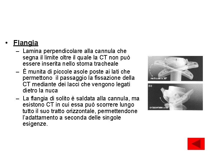 Caratteristiche intrinseche della CT • Flangia – Lamina perpendicolare alla cannula che segna il