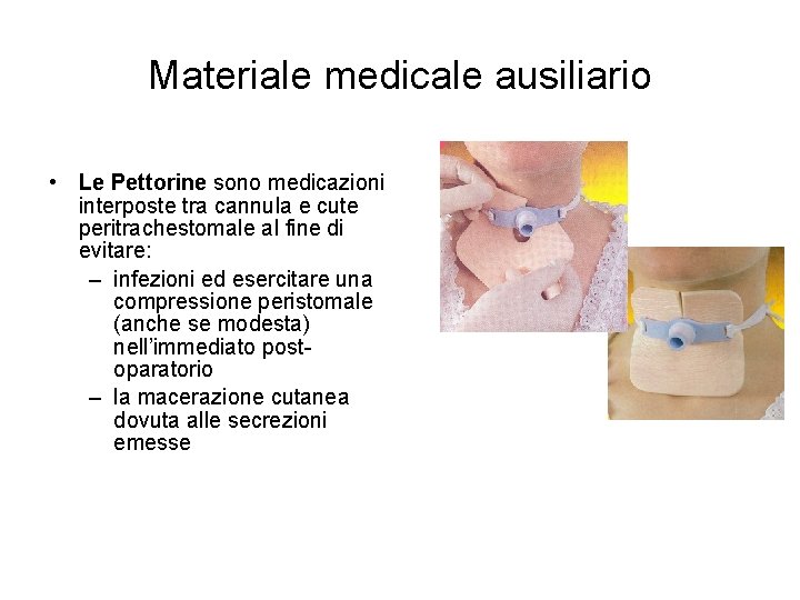 Materiale medicale ausiliario • Le Pettorine sono medicazioni interposte tra cannula e cute peritrachestomale Materiale medicale ausiliario • Le Pettorine sono medicazioni interposte tra cannula e cute peritrachestomale